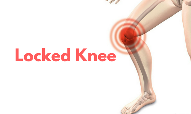 locked knee