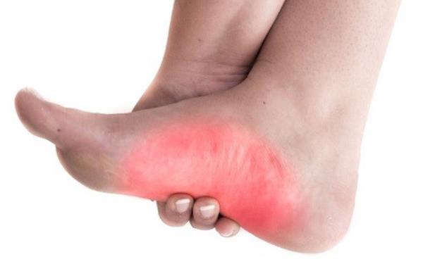 علت و درمان درد کف پا