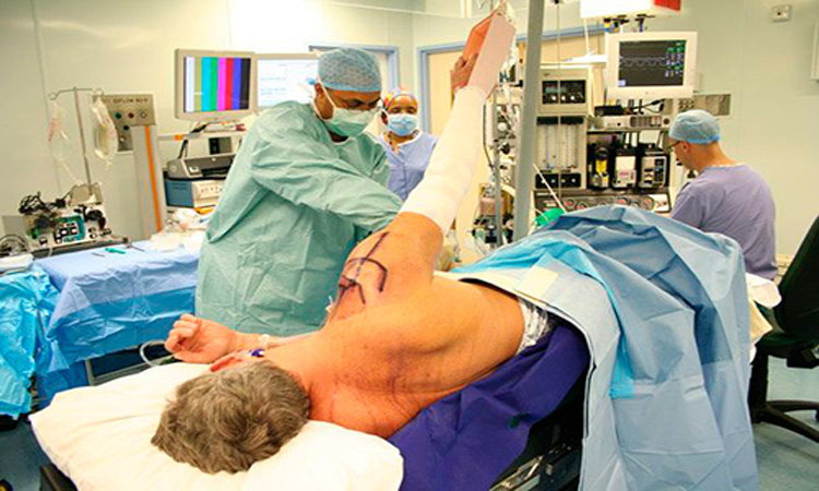 چطور تشخیص دهیم نیاز به جراحی مفصل شانه داریم