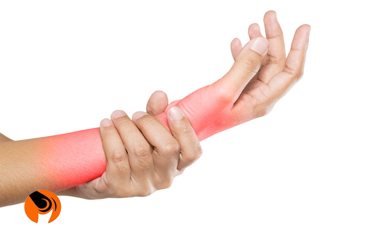 سندرم تونل کارپ از علت های درد ماهیچه بازو