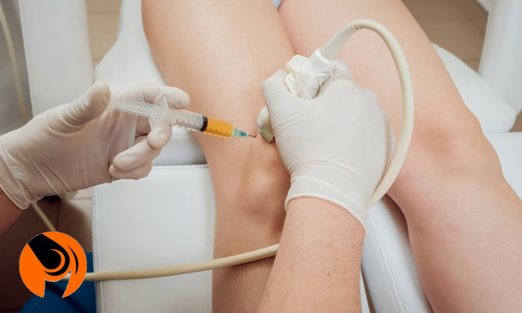 آمادگی لازم قبل از تزریق پی آر پی