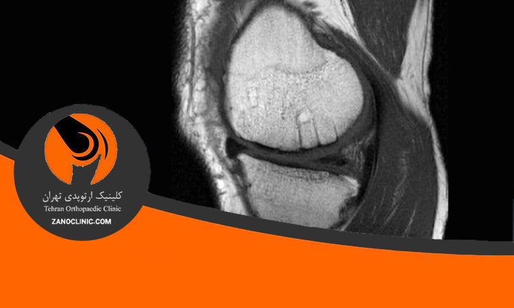 همه آنچه باید در مورد موزائیک پلاستی بدانید
