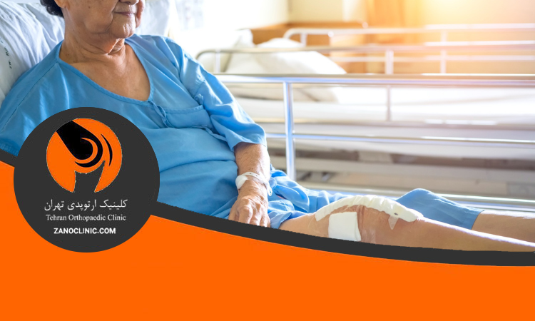 بهترین سن تعویض مفصل زانو