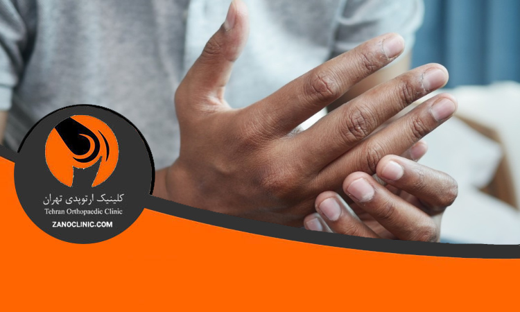 روش های پیشگیری از دررفتگی انگشت دست