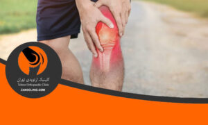 تأثیر تغذیه بر ترمیم مفصل زانو