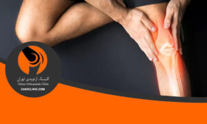 چرا تغذیه برای مفصل زانو اهمیت دارد؟