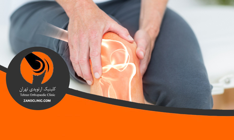تأثیر تغذیه بر ترمیم مفصل زانو