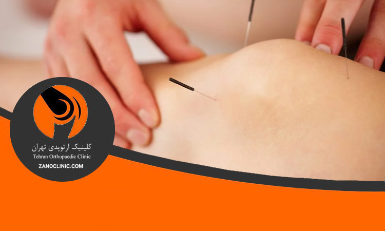 درمان مشکلات مفصل زانو با طب سنتی