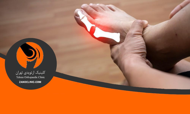 علائم شکستگی انگشت پا