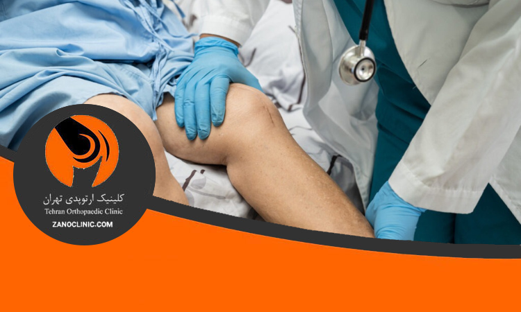 انواع روش های جراحی زانو