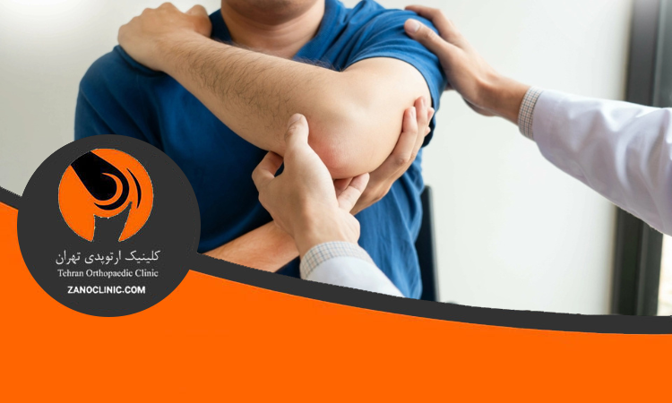 درمان در رفتگی کتف