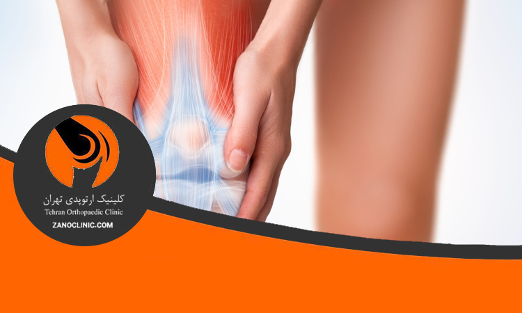 رباط ها و تاندون ها در استحکام مفصل زانو