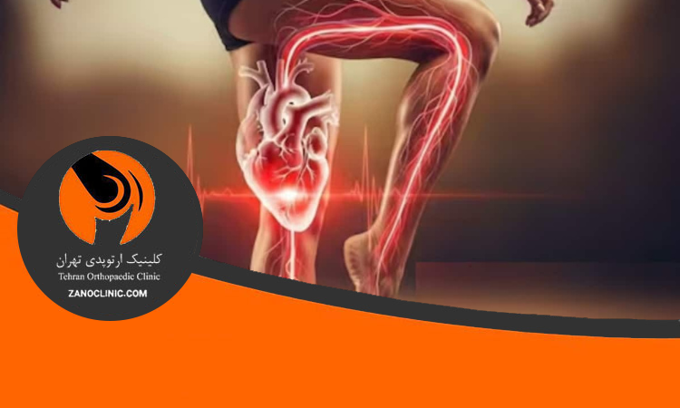 پا قلب دوم انسان