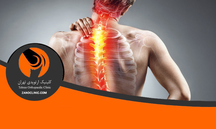 شایع ترین انواع اختلالات دیسک کمر