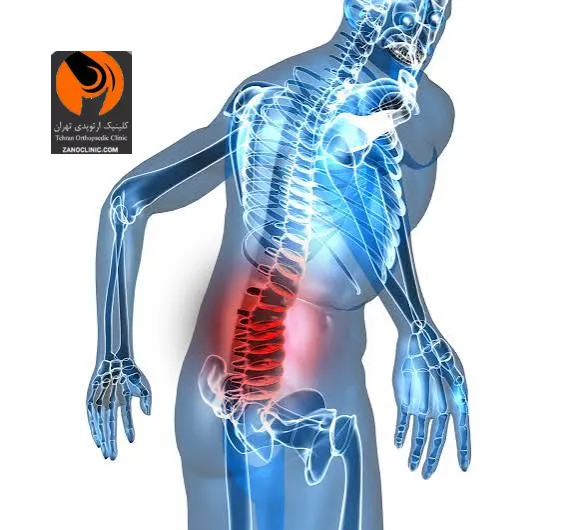 تنگی کانال نخاعی چگونه تشخیص داده می شود؟