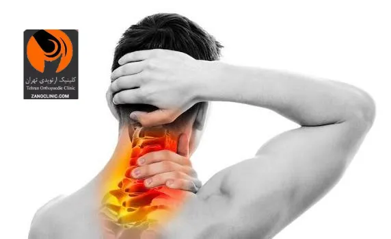 آرتروز گردن
