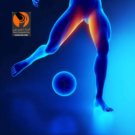 چرا فوتبالیست ها بیشتر درگیر آسیب کشدگی عضله کشاله ران می شوند؟