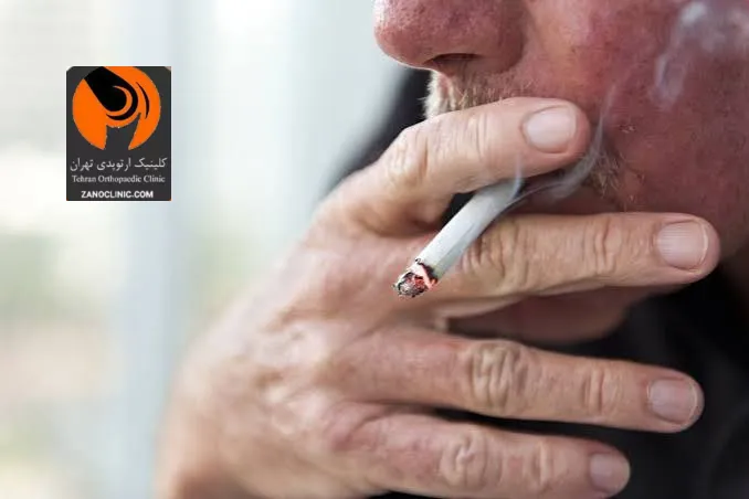 چه علائمی بعد از عمل مفصل زانو جدی و هشدار دهنده هستند؟