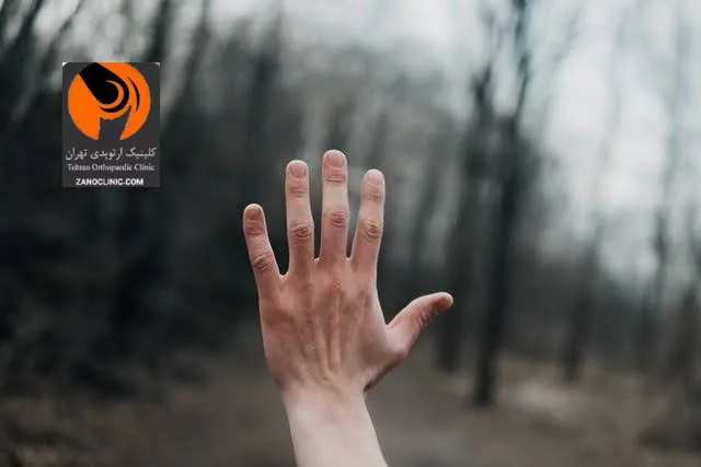 کم زور شدن دست دقیقا چیست و چه فرقی با خستگی معمولی دست دارد؟